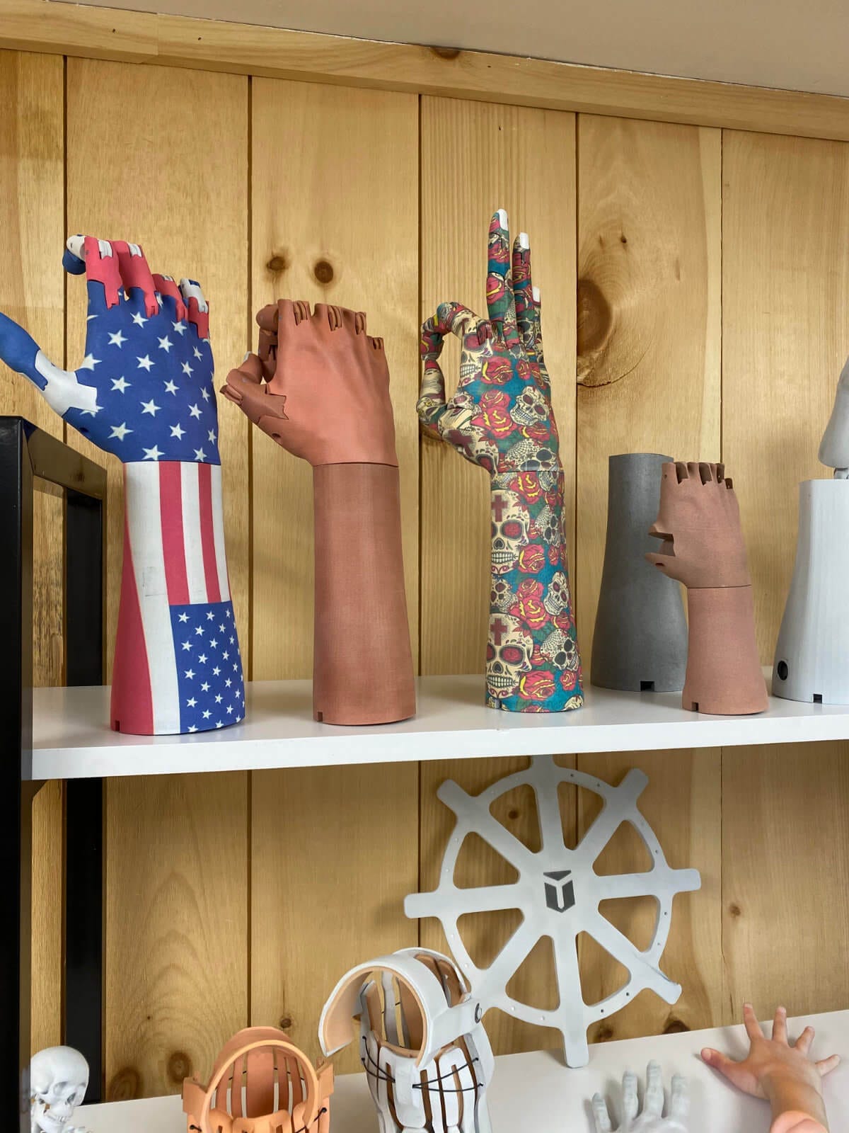 Prosthetic hands printed with several different artistic patterns at the Unlimited Tomorrow office in Rhinebeck NY